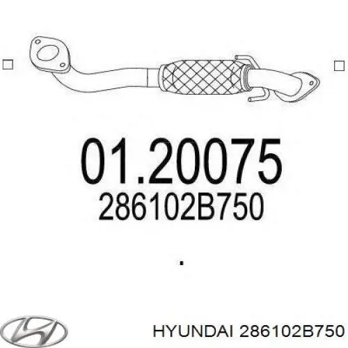 286102B750 Hyundai/Kia Tubo de admissão dianteiro (calças) do silenciador