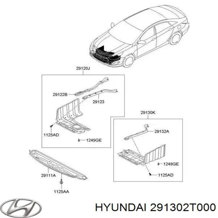 291302T000 Hyundai/Kia Proteção de motor esquerdo