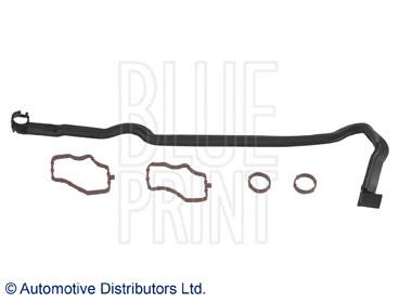 7701476555 Renault (RVI) Vedante da tampa de válvulas de motor, kit