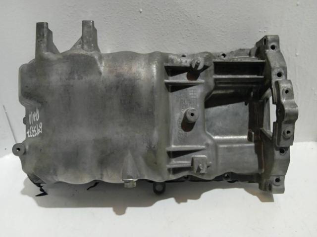 Panela de óleo de cárter do motor 215102A101 HYUNDAI