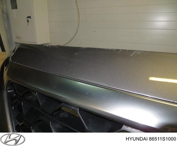 Moldura superior de grelha do radiador Hyundai/Kia 86374S1000 preço, a partir de 412,80 USD